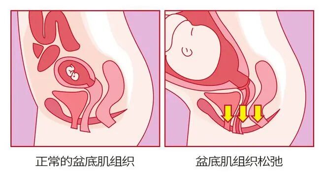 盆底组织 盆底组织