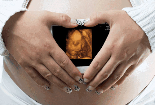 胎儿影像
