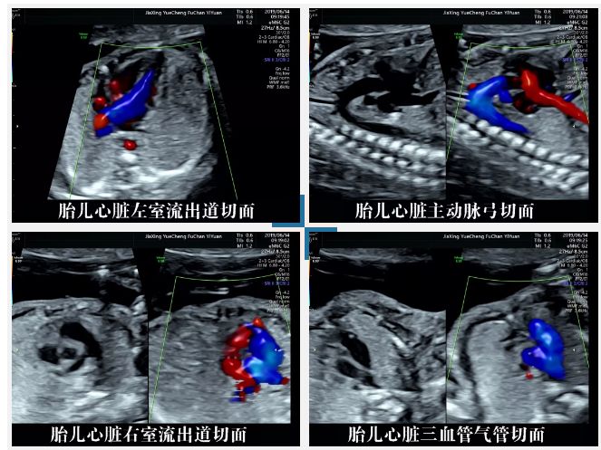 四维彩超画面