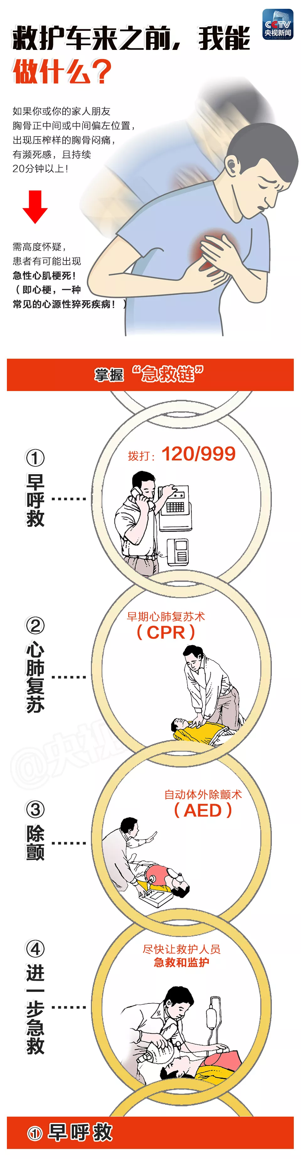 心肺复苏1