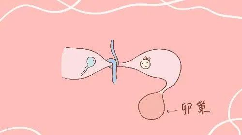 输卵管吻合术