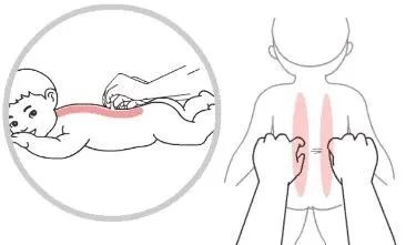 小儿推拿
