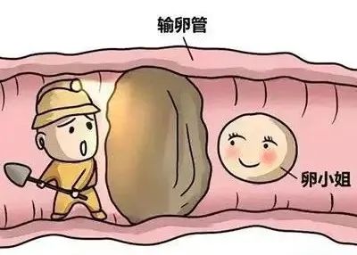 输卵管堵塞1